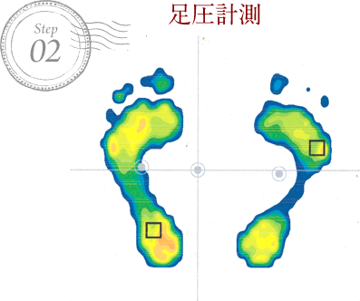 足圧計測